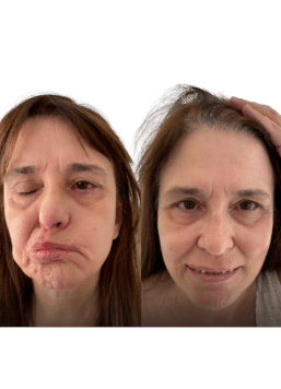 BANNER 4 LANDING PARALISIS 257 x 356 px 1